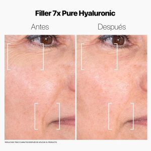 Филлер 7x Pure Hyaluronic Instant Wrinkle Filler для морщин с 7 видами гиалуроновой кислоты 15 мл