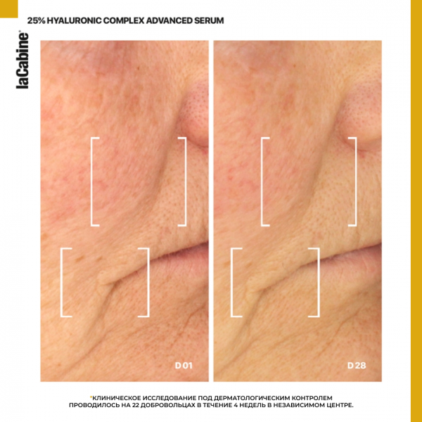 Сыворотка 25% Hyaluronic Complex Advanced с 7 видами гиалуроновой кислоты и Витамином С