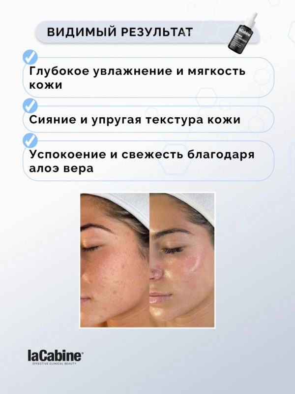 Пилинг Niacinamide [Pro] для лица с ниацинамидом, против пигментации и постакне, 30 мл